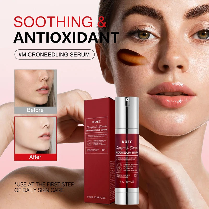 Spicule Microneedling Serum,Pore Exfoliation,Centella Asiatica Propolis Aloe Extract Moisturizing Booster,Korean Glass Skin Care