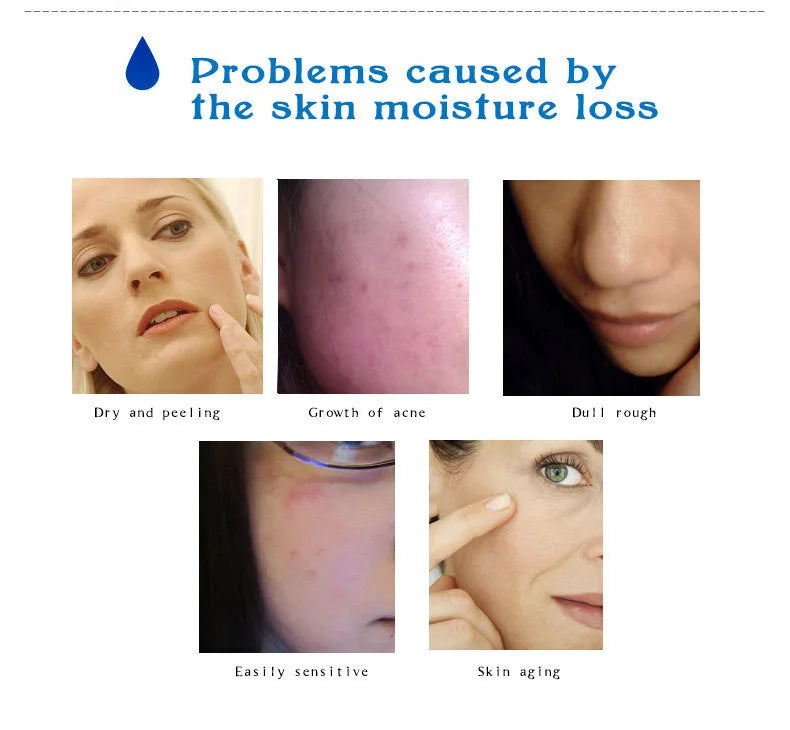 ARTISCARE Hyaluron Acid Serum 10pcs/Lot for Face Moisturizing and Hydrating Skin Care Essence Facial Care