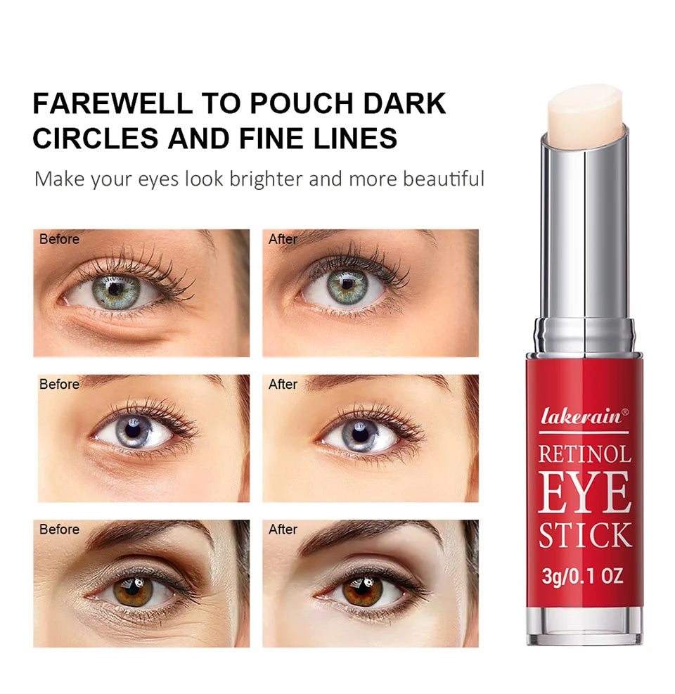 Lakerain Retinol Eye Cream Stick – Dark Circles, Puffiness & Fine Lines | Anti-Aging Eye Serum for Women 3g