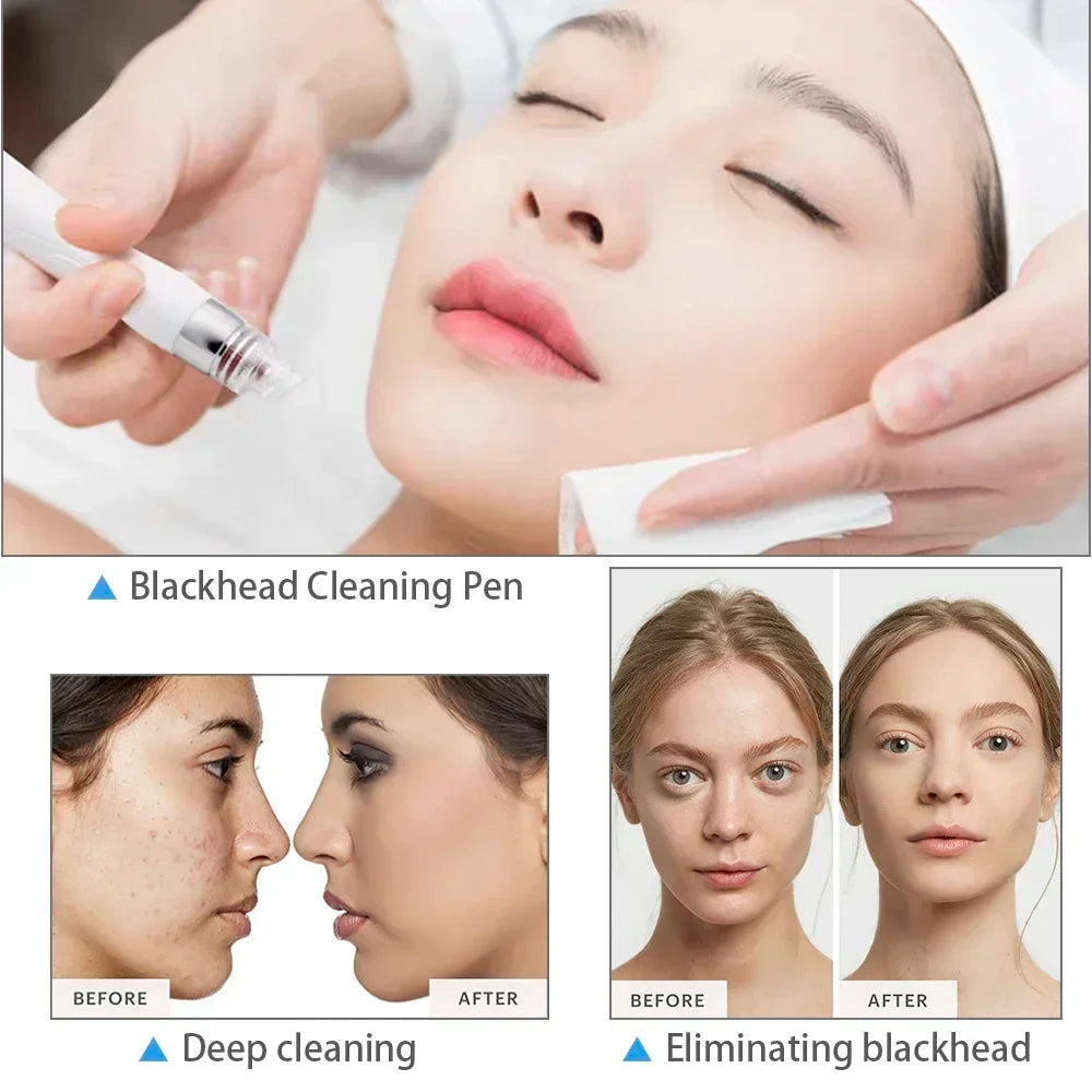 Misheart 6-in-1 Professional Beauty Facial Mask Machine Deep Cleaning Skin Care Equipment (Fast Delivery From EU Warehouse)