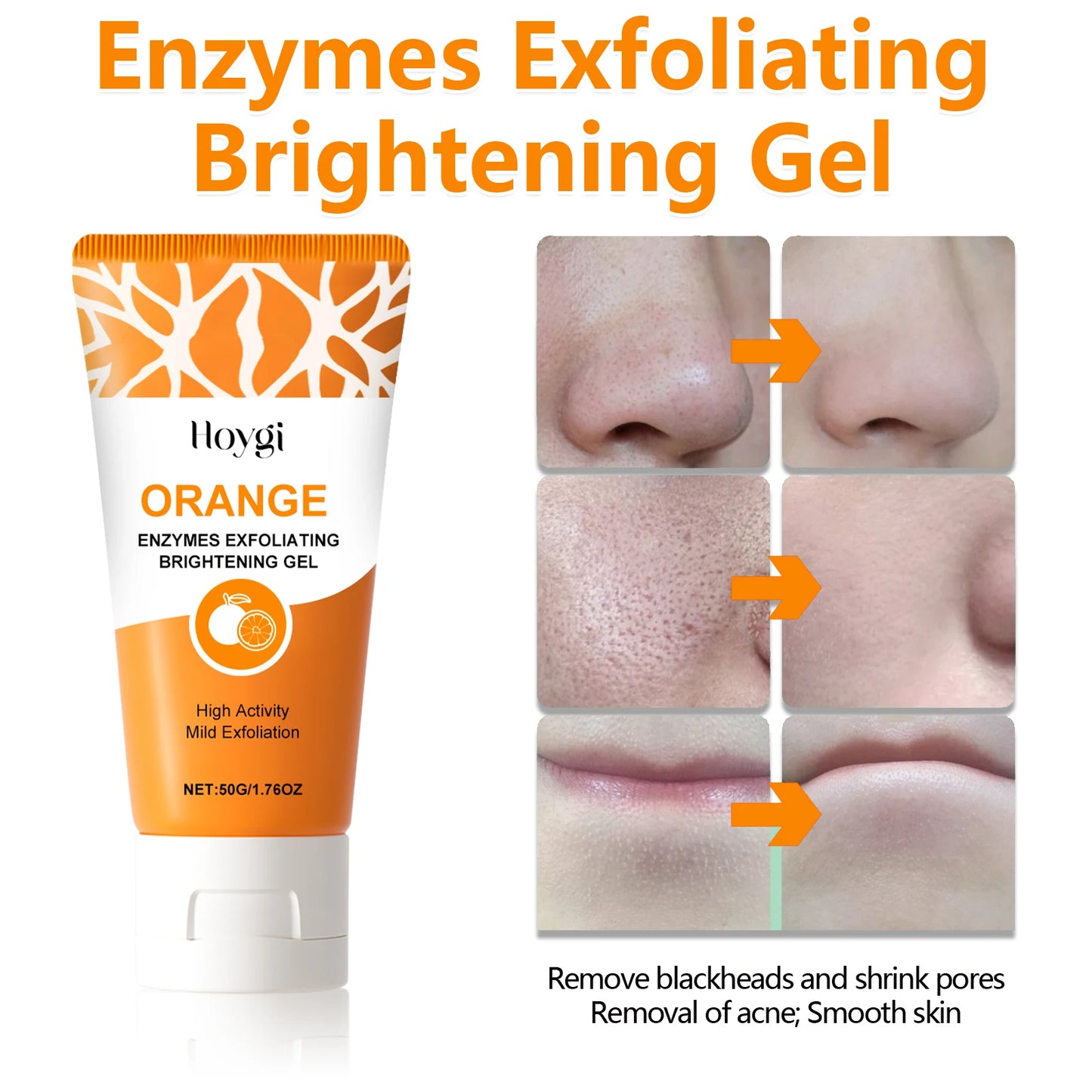 Exfoliating Blackhead Gel with Protease&Niacinamide Pore Purifying &Brighten skin tone,Ascorbic Acid,Gentle Dead Skin Remover.