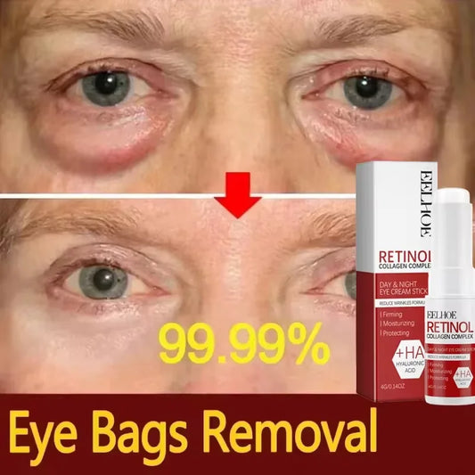 Firming Eye Stick — Smoothing Balm for Puffy, Tired Eyes