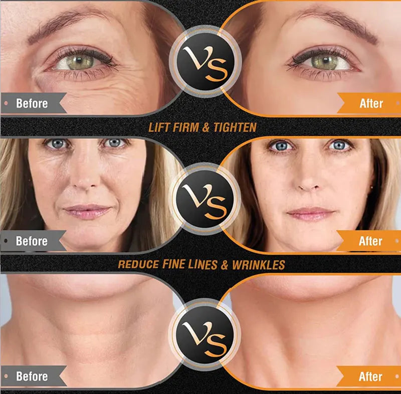 EMS Facial Body Radio Frequency Machine Skin Tightening Face Lifting RF Beauty Device Professional Home RF Skin Care Anti Aging, women