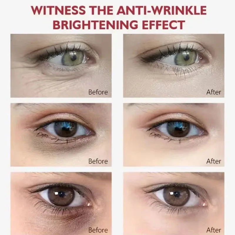 7 Day Tighten Wrinkles Eye Cream Remove Eye Fat Bags Puffiness Lifting Firming Smooth Eye Massage Cream Nourish Eye Skin Care