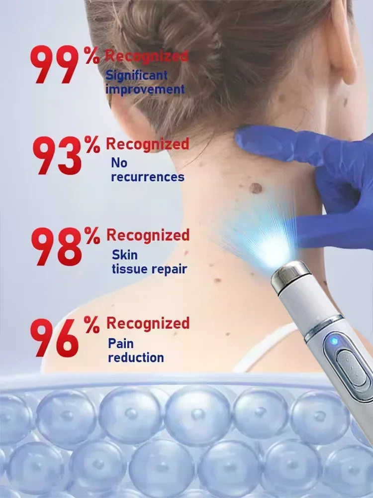 Blue light wart removal tools to make your life better.