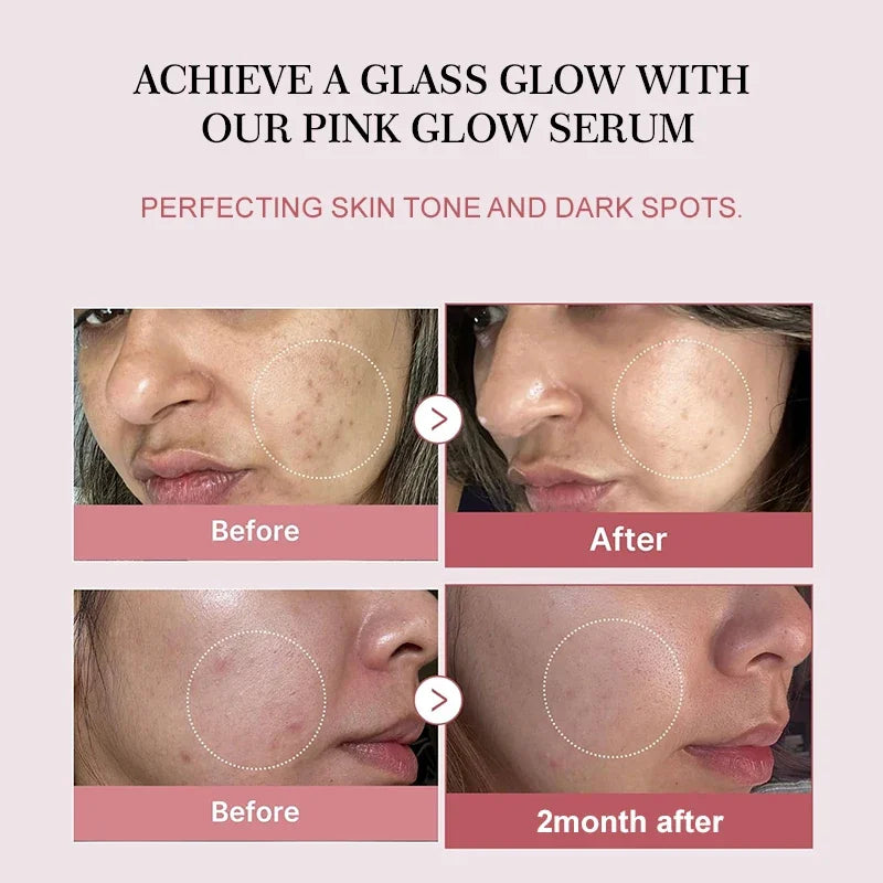 Salmon PDRN Collagen Peptide Facial Serum for Dull Skin - Boosts Elasticity Skin Renewal Repair Korean Beauty Product