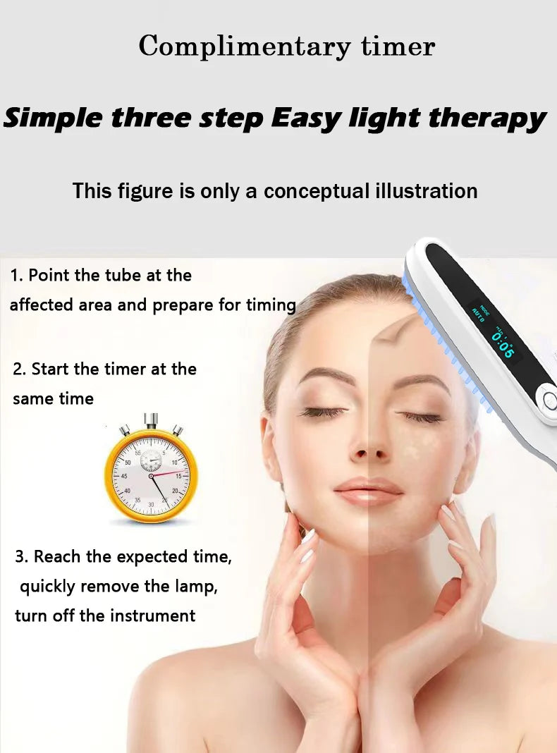 311NM  UVB Narrow Band UV Light Source Treatment Vitiligo Psoriasis Eczema Therapy Lamp Ultraviolet Phototherapy Instrument
