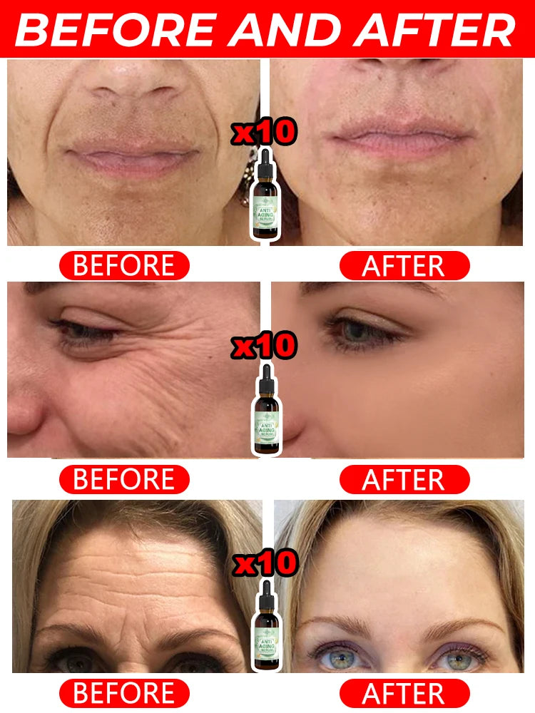 Anti-Aging Instant Wrinkle Smoothing Cream – Look 20 Years Younger | Fine Lines & Firming Face Treatment