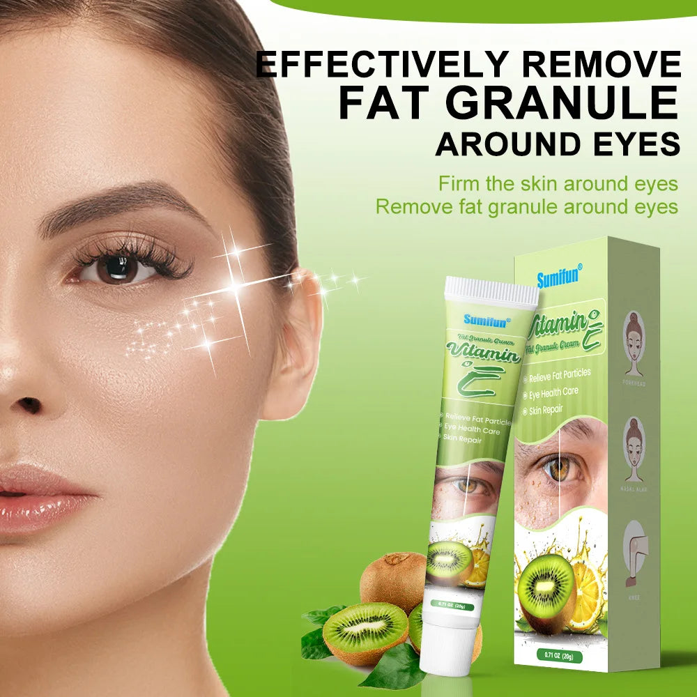 Fat Granules Remover Eye Cream Effective Remove Fat Granules Puffiness Anti-Particles Milia Remover Product Repair Eye Skin Care