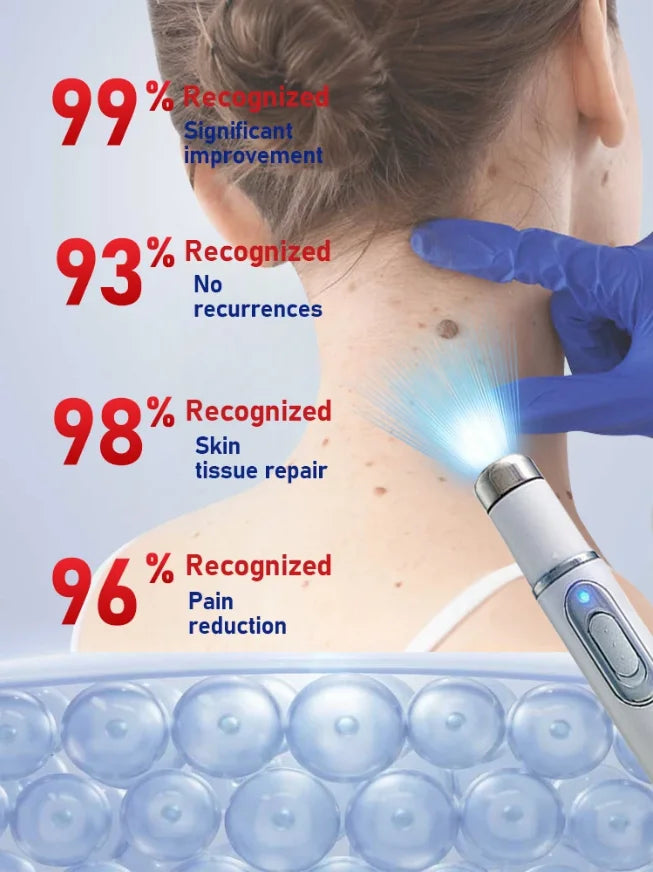 Blue light wart removal tools to make your life better.