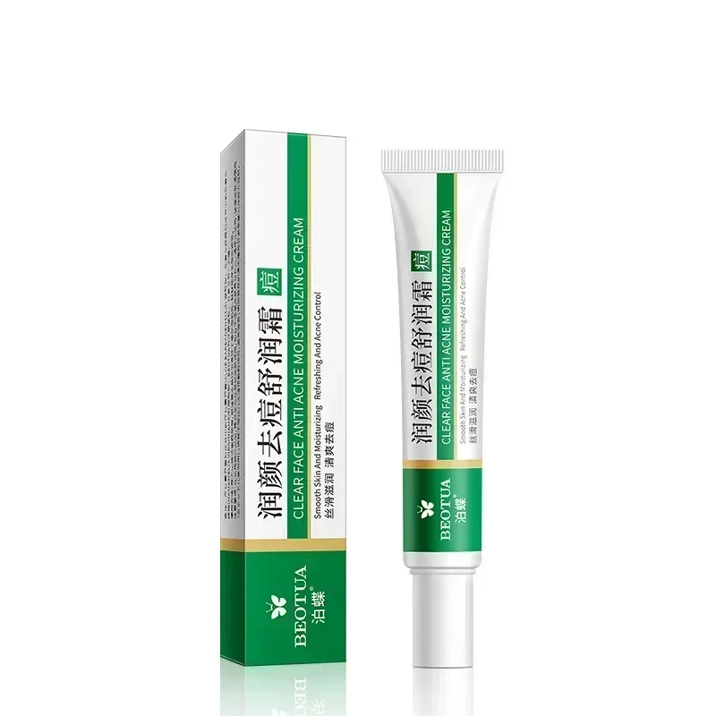 Herbal Acne & Blackhead Cream – Oil-Control, Pore-Refining Gel for Blemish-Prone Skin