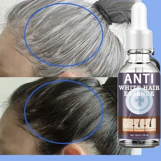 White hair killer, remove gray hair and restore natural hair color in 7 days