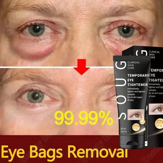 Firming Eye Cream — 7-Day Smoothing Massage Treatment