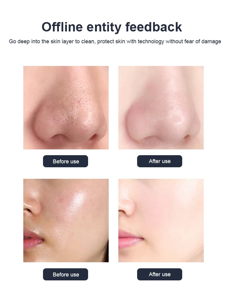 The New 10 In 1 Aqua Peeling Lift Skin Bubble Moisturizer Oxygen Machine Skin Care Cleansing Facial Dermabrasion Equipment