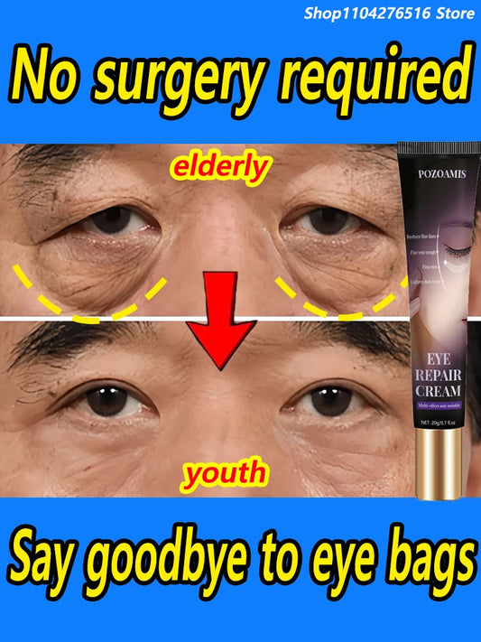 Intensive Eye Cream — Dark Circle & Eye Bag Care