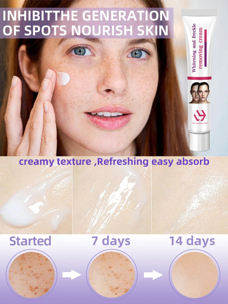 Facial Lightening for Freckles, Melasma & Dark Spots