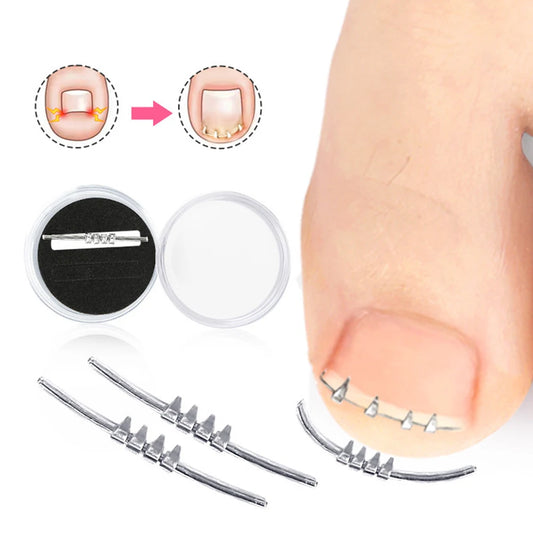 Ingrown Toenail Pedicure Tool Embed Toe Nail Care Straightening Correction Clip Curved Clamp Toenails Correction Tool for Toes