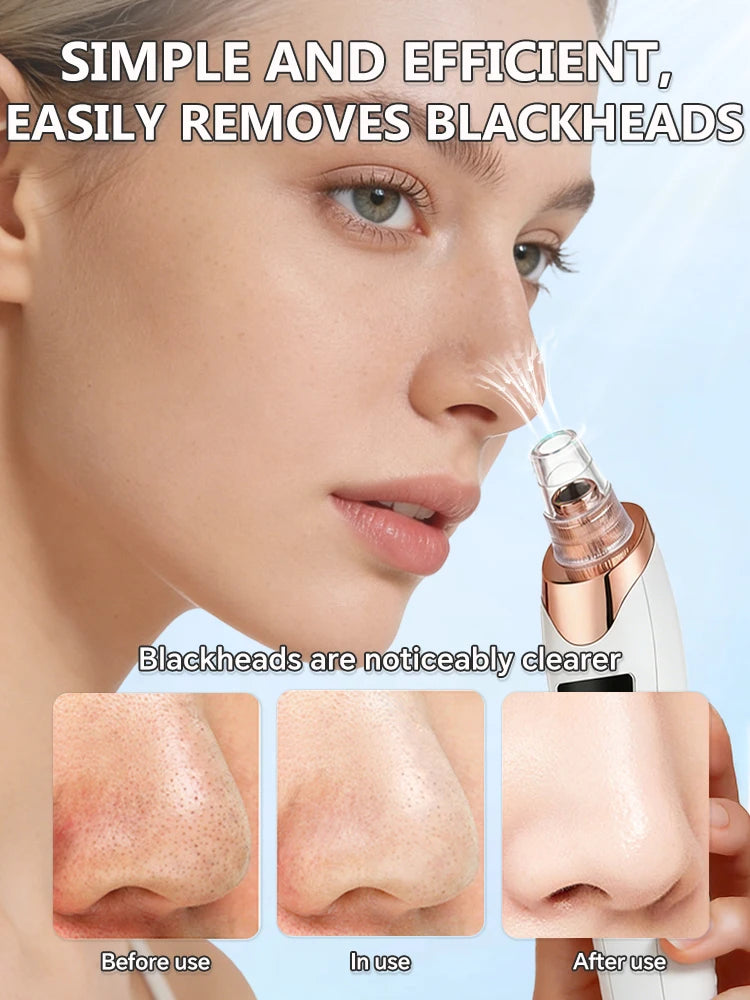 Electric Blackhead Remover Vacuum – Pore Cleaner & Acne Extractor | Facial Deep Cleaning Tool