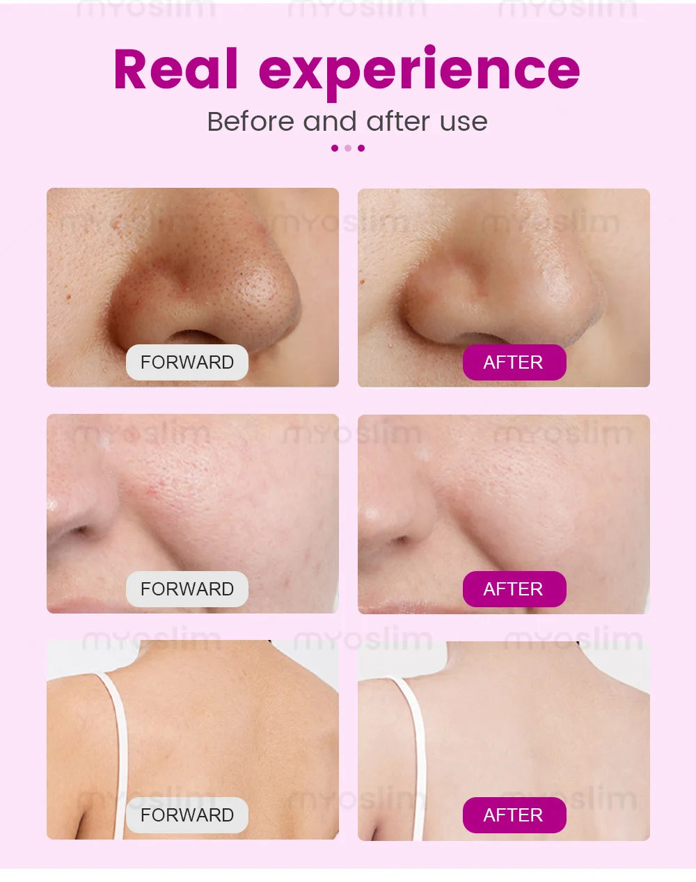 4 In 1 Hydra Oxygen Facial Machine Hydro Dermabrasion Deep Pore Cleansing Blackhead Removal Hydrating Photon Skin Rejuvenation S
