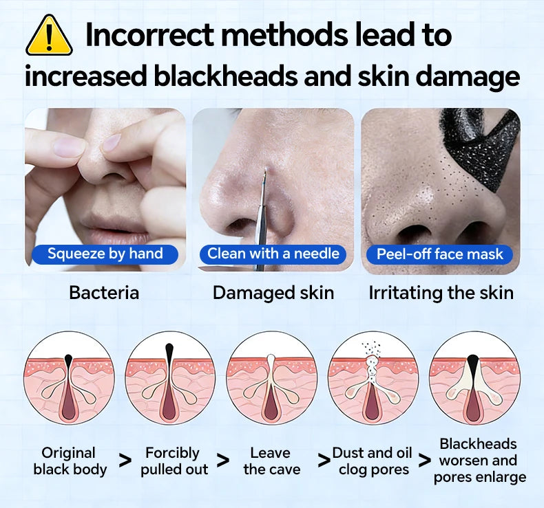 Electric Blackhead Remover Vacuum – Pore Cleaner & Acne Extractor | Facial Deep Cleaning Tool
