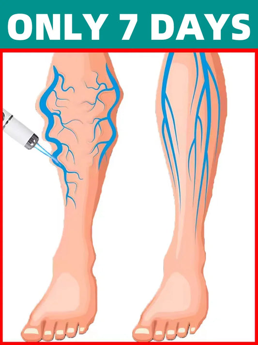 2026 New Blue Light Pen to Solve Venous insufficiency Legs care Tools