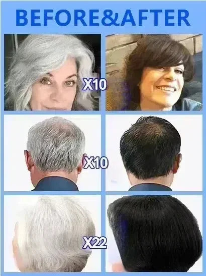 White hair killer, remove gray hair and restore natural hair color in 7 days 2025
