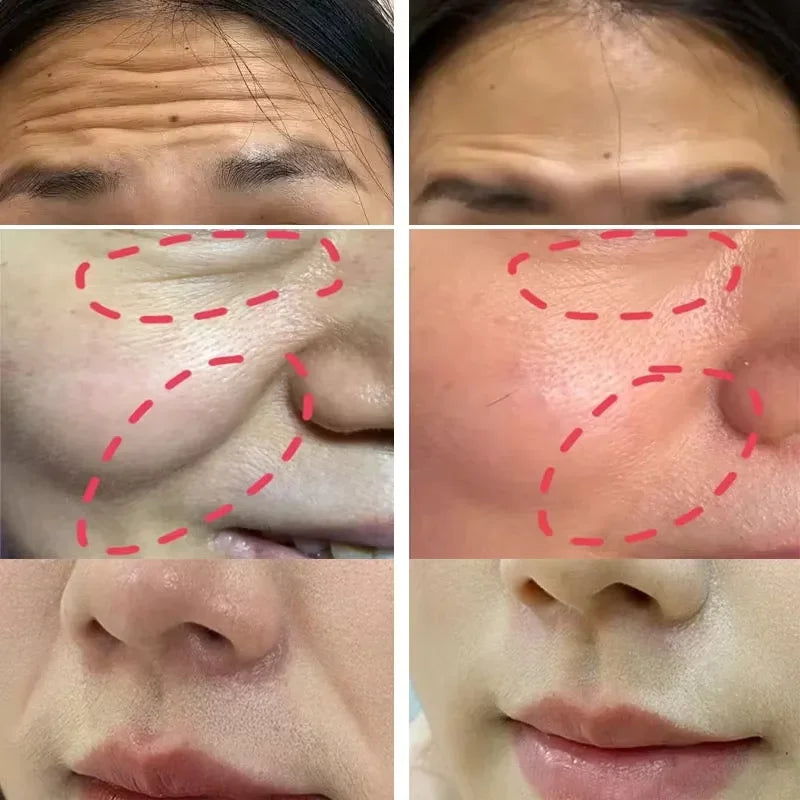 Eelhoe Collagen & Hyaluronic Acid Multi Bounce Balm Stick 9g – Instant Anti-Aging, Wrinkle Reduction, Brightening & Moisturizing | CPNP Certified