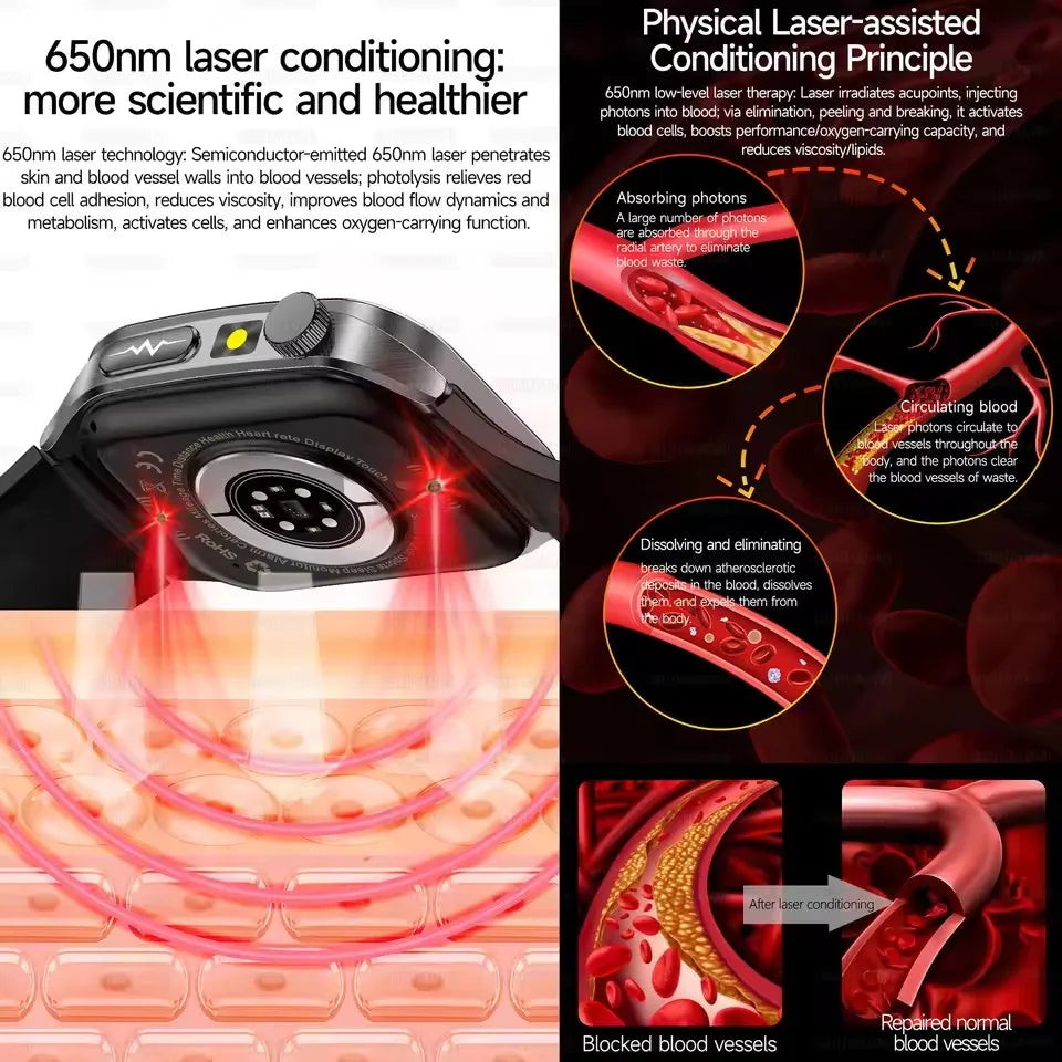 2026 AI-GPT ECG Health Smartwatch – Blood Pressure, Lipid, Uric Acid & 650nm Dual-Probe Laser | Men & Women