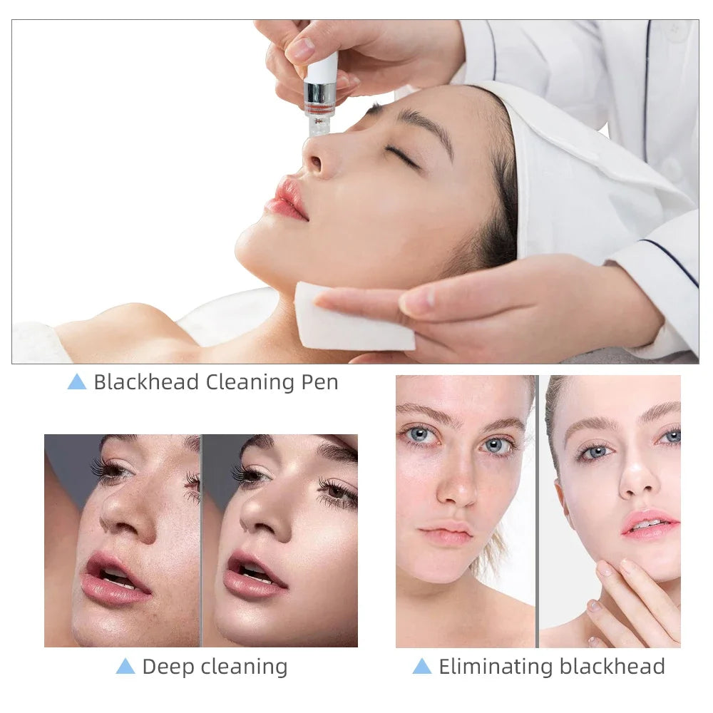 7in1Small Bubble Facial Machine Water Oxygen Jet Hydro Diamond Peeling Microdermabrasion Deep water replenishment Deep cleaning