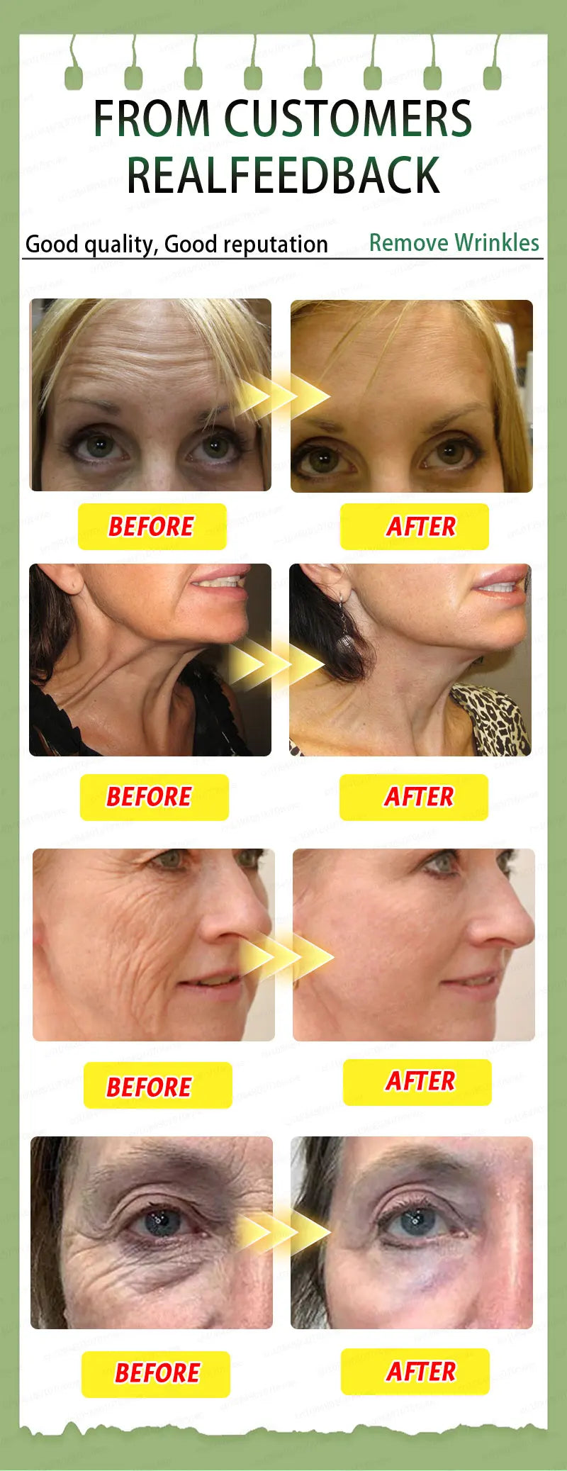 Anti-Aging Instant Wrinkle Smoothing Cream – Look 20 Years Younger | Fine Lines & Firming Face Treatment