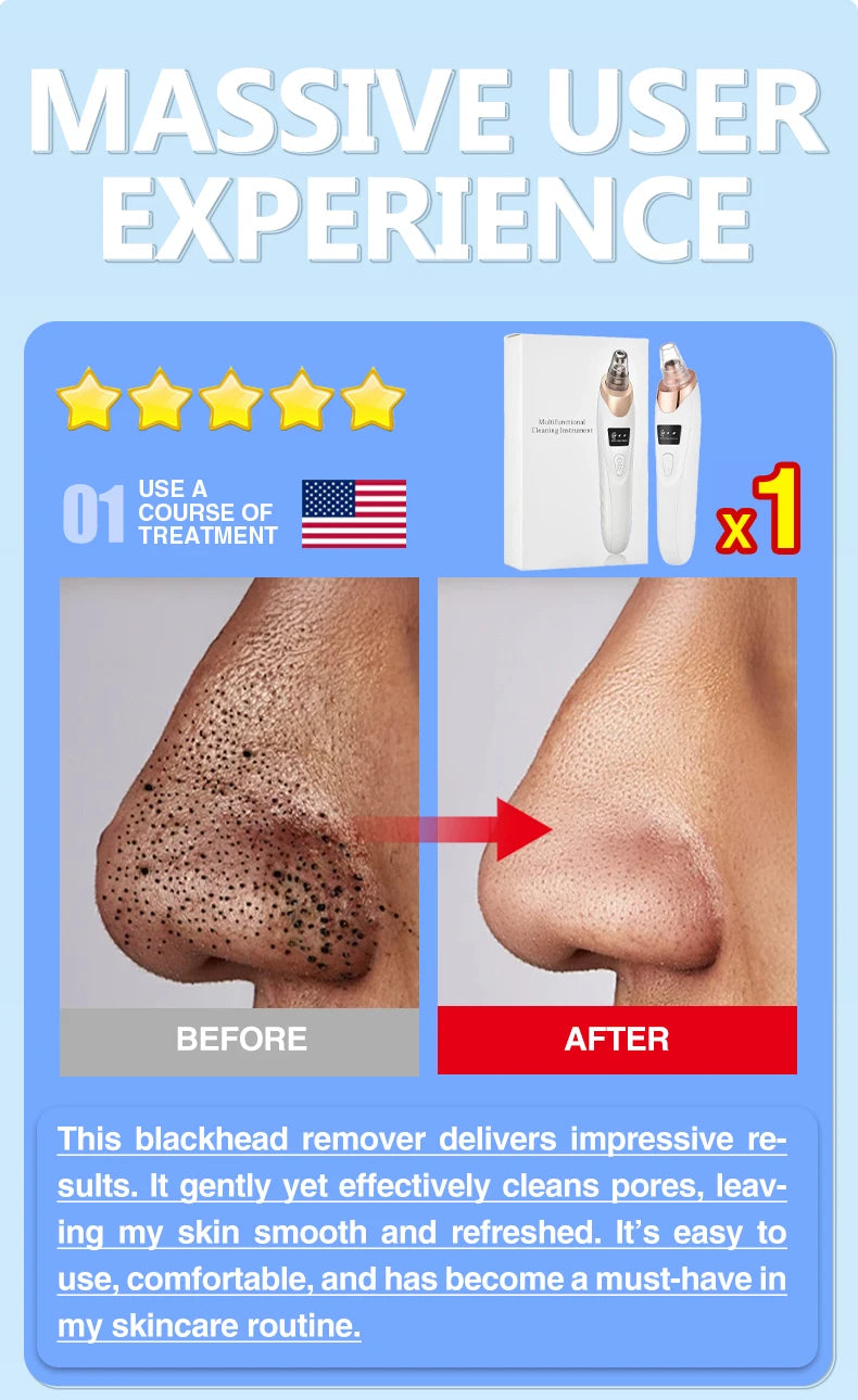 Blackhead Remover Pore Cleaner Black Dots Vacuum Cleaner Skin Pimple Acne Extractor Facial Cleaning Electric Black Head Removal.