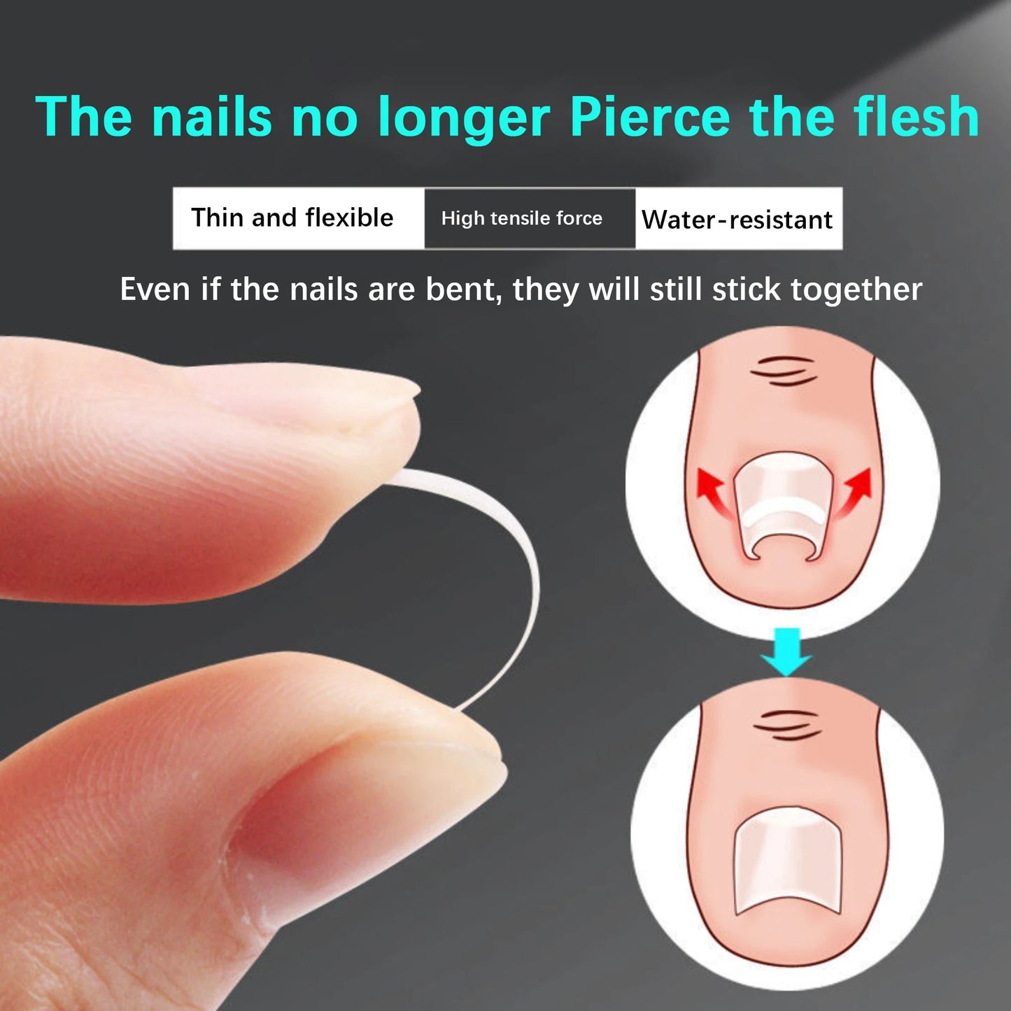 50Pcs Ingrown Toenail Correction Tool Ingrown Toe Nail Treatment Elastic Patch Sticker Straightening Clip Brace Pedicure Tool