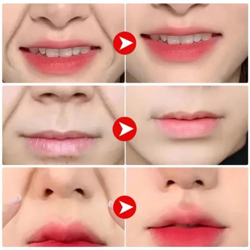 Collagen PDRN Nasolabial Folds Patch Contain Hyaluronic Acid Instant Fade Fine Lines Firming Skin Deep Moisturizing Facial Mask